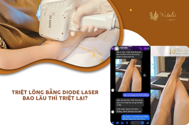 triệt diode triệt lại