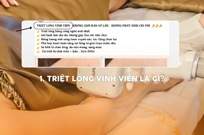 triệt lông vĩnh viễn là gì?