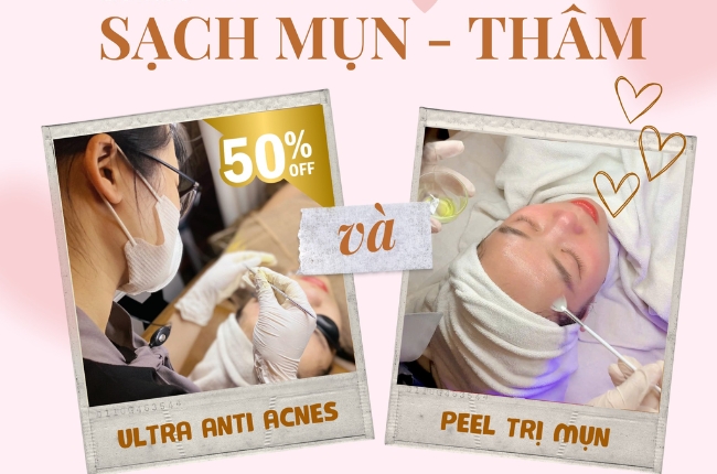 ưu đãi mụn thâm