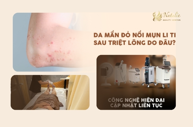 nguyên nhân da mẩn sau triệt