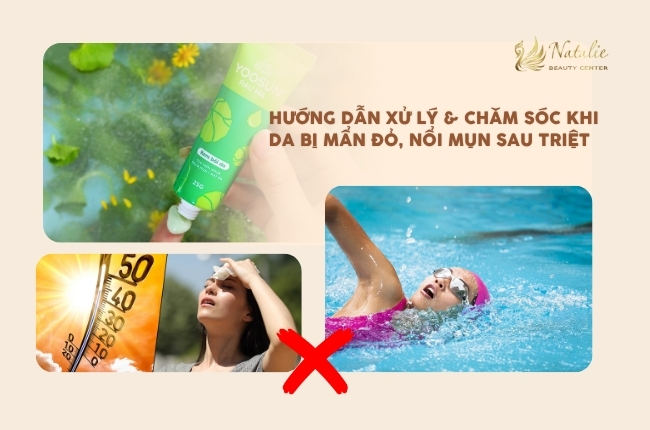 hướng dẫn xử lý sau triệt