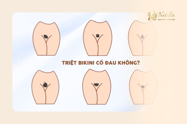 hình ảnh triệt bikini