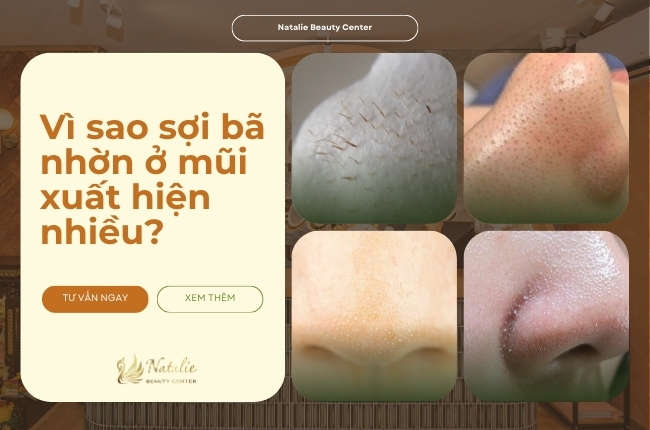 vì sao sợi bã nhờn ở mũi xuất hiện nhiều