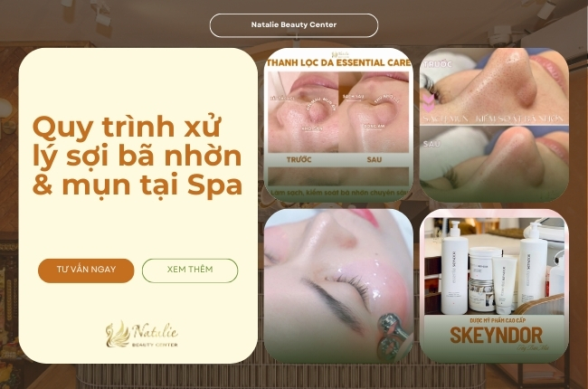 quy trình xử lý sợi bã nhờn