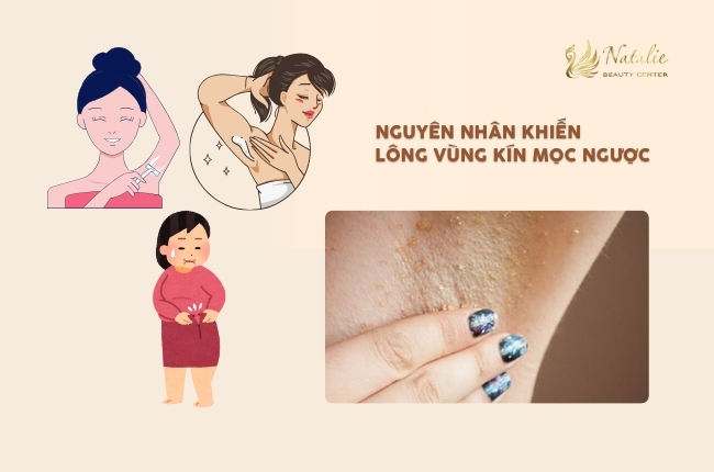 nguyên nhân mọc ngược