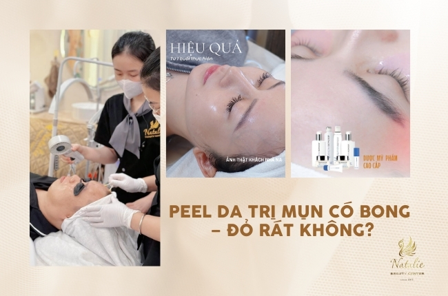 peel da mụn có bong đỏ rát không
