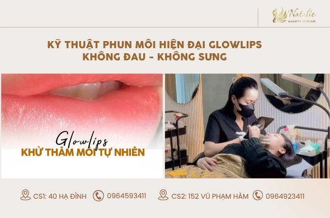 kỹ thuật phun glow na