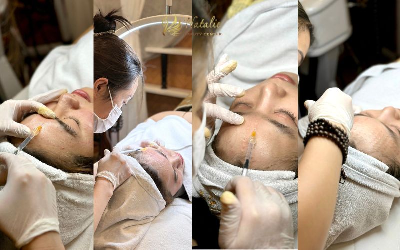 Tiêm meos bằng tay