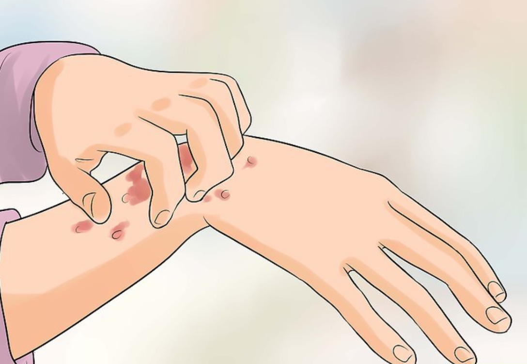 tầm-quan-trong-của-việc-phòng-ngừa-STDs-2