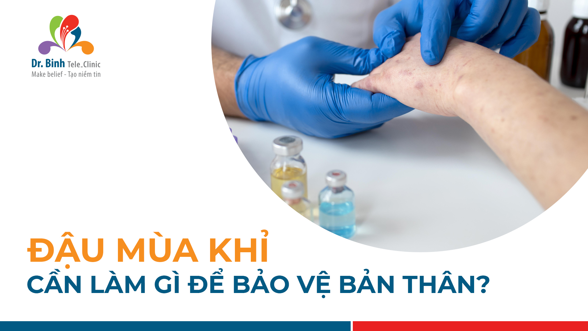 can-lam-gi-de-ngua-benh-dau-mua-khi