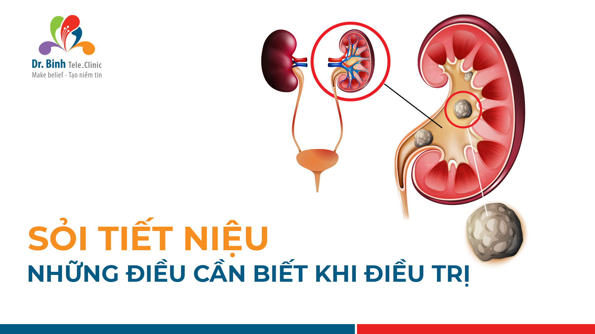 nhung-dieu-can-biet-ve-soi-tiet-nieu