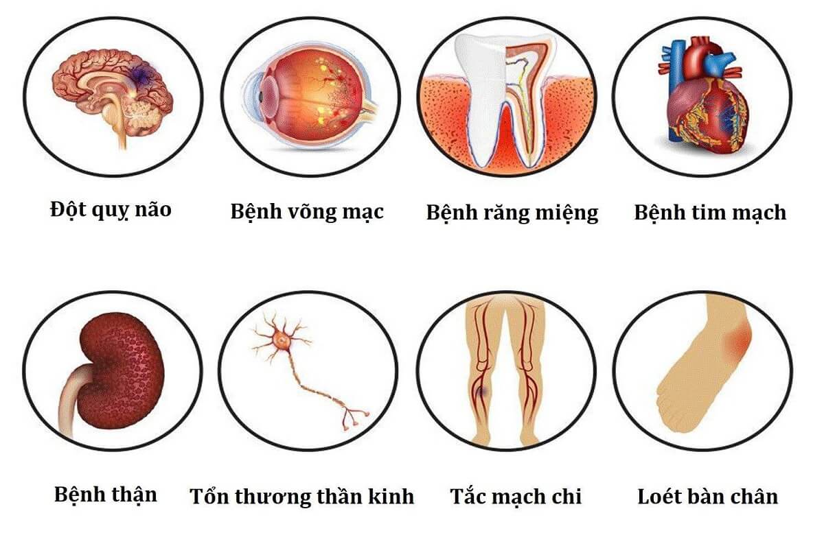 biến-chứng-của-tiểu-đường
