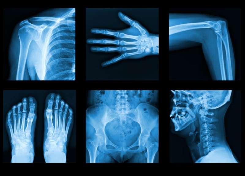 Chẩn đoán hình ảnh X-quang