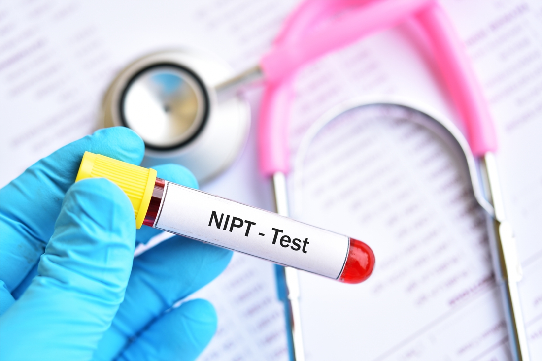 Tất cả các thai phụ nên thực hiện làm xét nghiệm NIPT từ tuần thai thứ 10