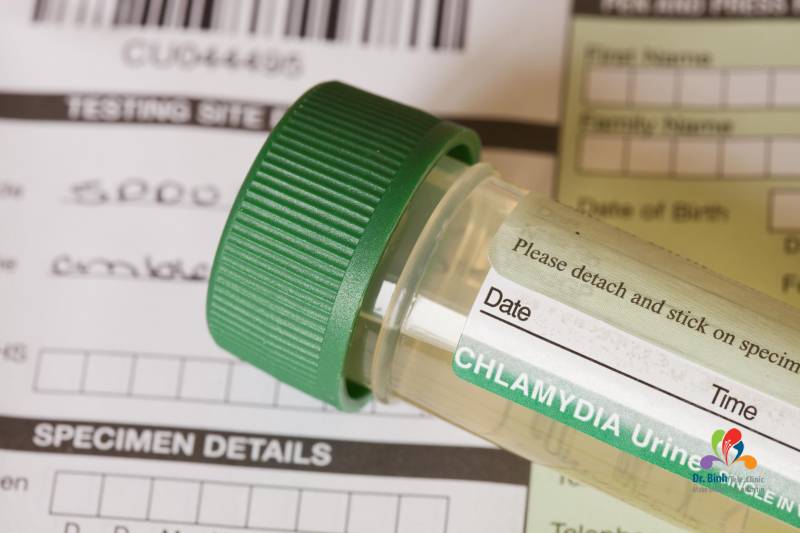 Yếu tố ảnh hưởng tới kết quả xét nghiệm test nhanh phát hiện khuẩn Chlamydia