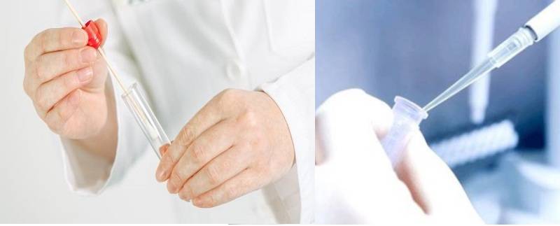 Quy trình thực hiện Test nhanh Chlamydia ở ngưởi trong 30 phút