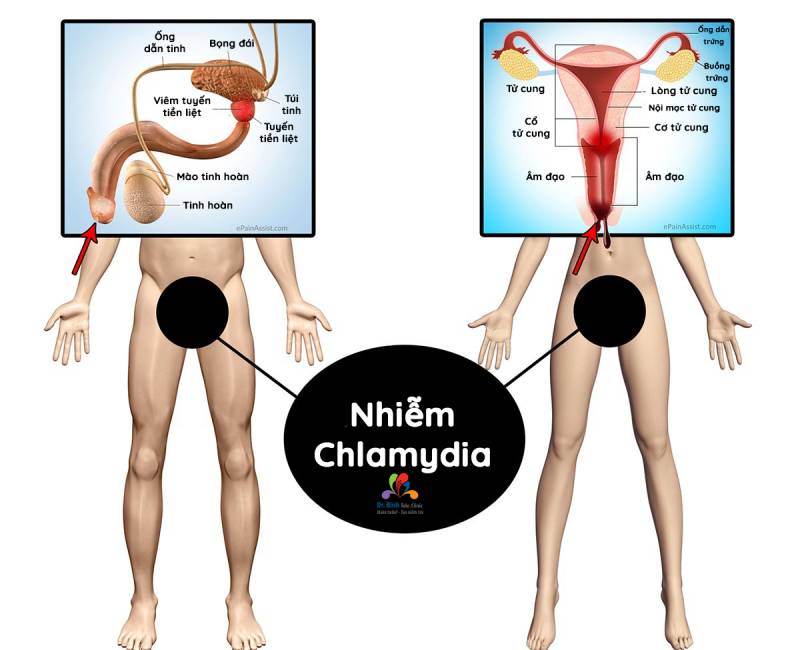 Nhận tư vấn điều trị phù hợp với tình trạng cơ thể từ bác sĩ chuyên khoa khi có kết quả xét nghiệm dương tính