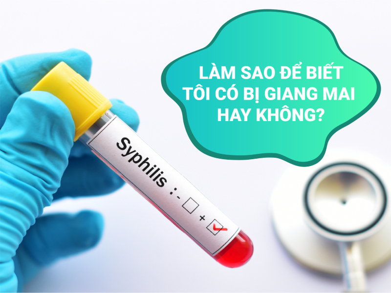 Phương pháp xét nghiệm và chẩn đoán giang mai ở nữ và nam