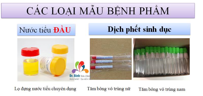 Các loại mẫu dịch được sử dụng trong xét nghiệm Chlamydia nhanh tại các cơ sở y tế