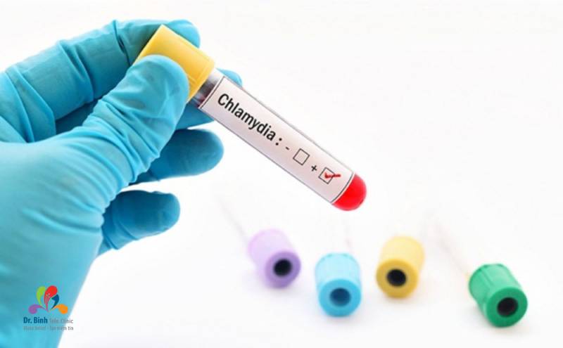 Thực hiện xét nghiệm và chuẩn đoán chính xác bệnh Chlamydia
