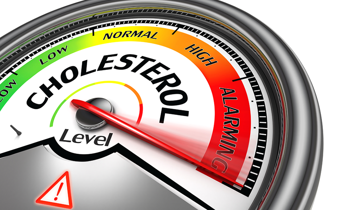 Mỡ máu - Cholesterol cao và nguy cơ mắc bệnh mạch vành