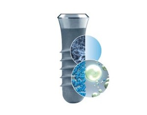 Hệ thống implant sử dụng