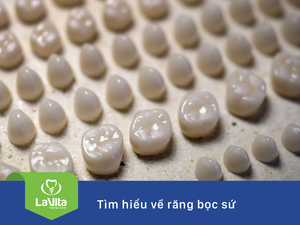 Bọc răng sứ thẩm mỹ