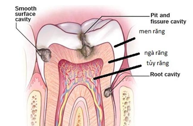 Cấu trúc giải phẫu răng