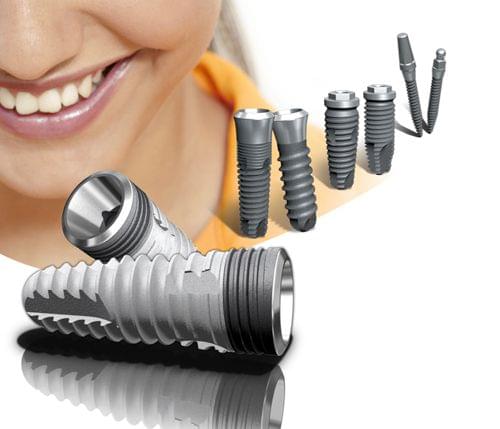 Cấy ghép Implant có đau không