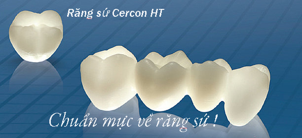 răng sứ không kim loại cercon