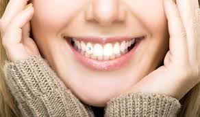 dinh kim cuong tren rang