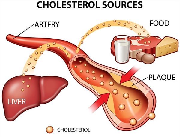 Cholesterol toàn phần (cholesterol total) trong máu