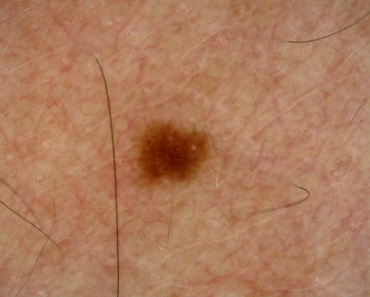 Ứng dụng kính hiển vi điện tử Dino-lite trong lĩnh vực chăm sóc sức khỏe