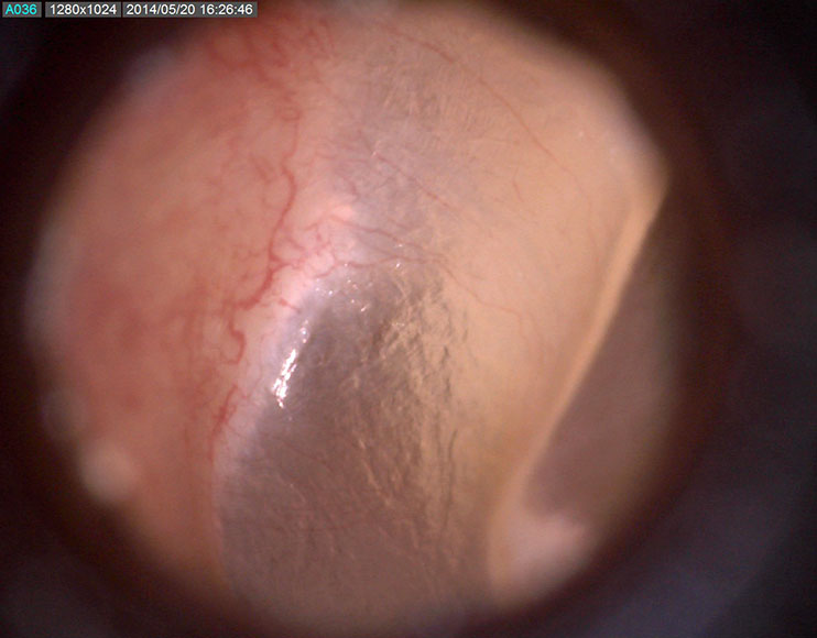 Ứng dụng kính hiển vi điện tử Dino-lite trong lĩnh vực chăm sóc sức khỏe