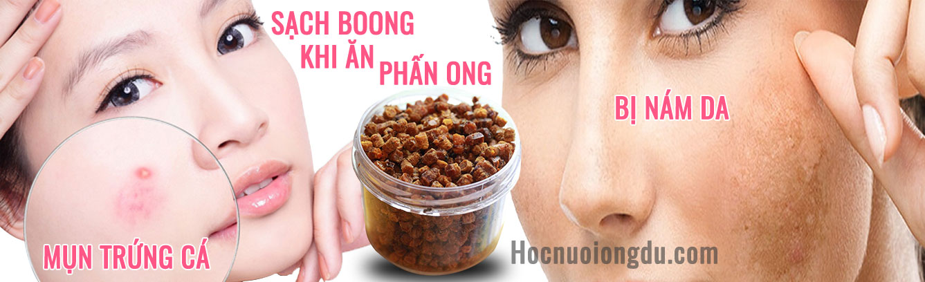 cách trị mụn trứng cá và nám da bằng phấn ong