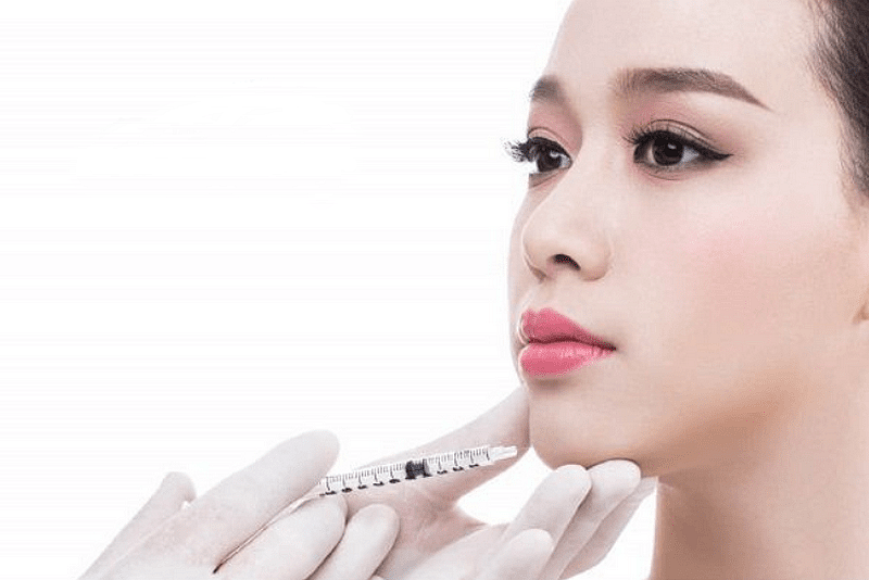 Tiêm filler cằm bao lâu thì ổn định?