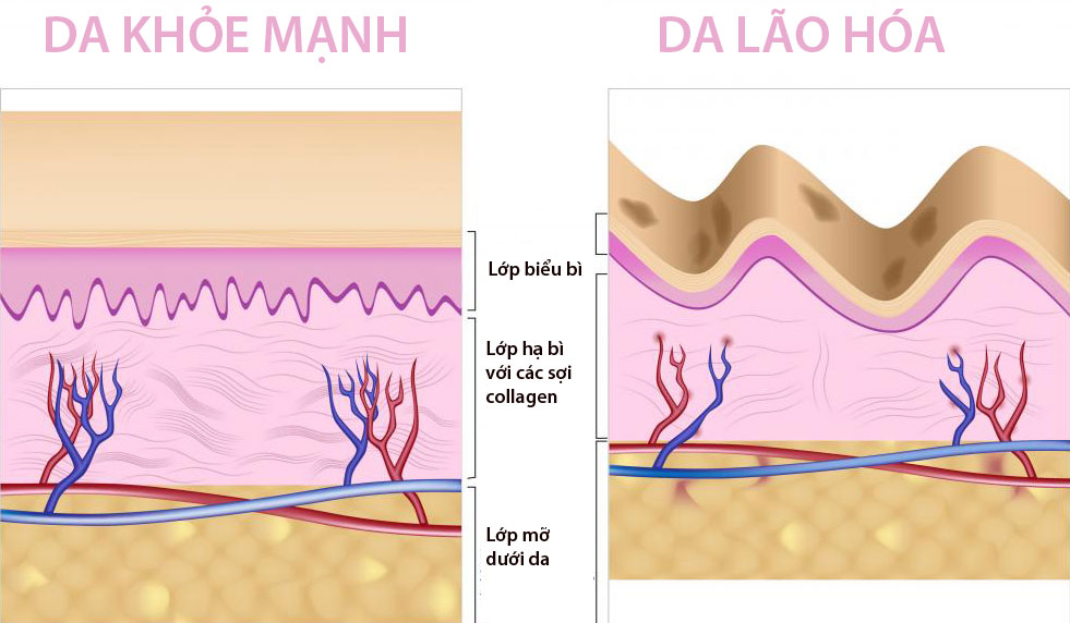 uong-collagen-loai-nao-tot-nhat-de-chong-lao-hoa-da-1