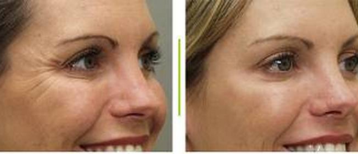 Kem dưỡng da Fine Line