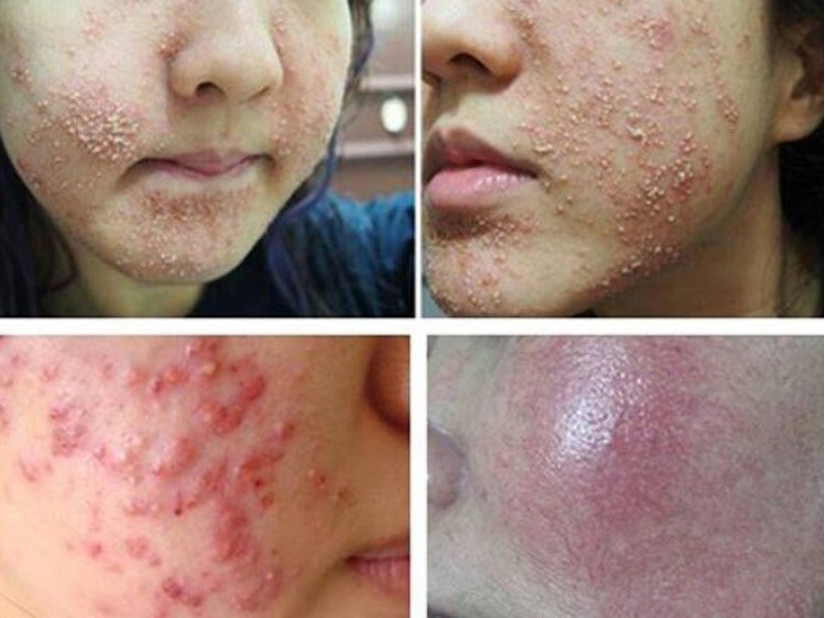 Sử dụng mỹ phẩm giả có thể gặp phải nhiều tác hại