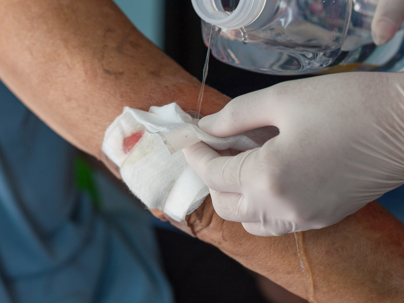 Các y bác sĩ đang rửa sạch vết thương cho bệnh nhân một cách nhẹ nhàng