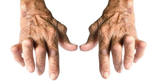 Bài thuốc dân gian chữa viêm khớp dạng thấp an toàn hiệu quả