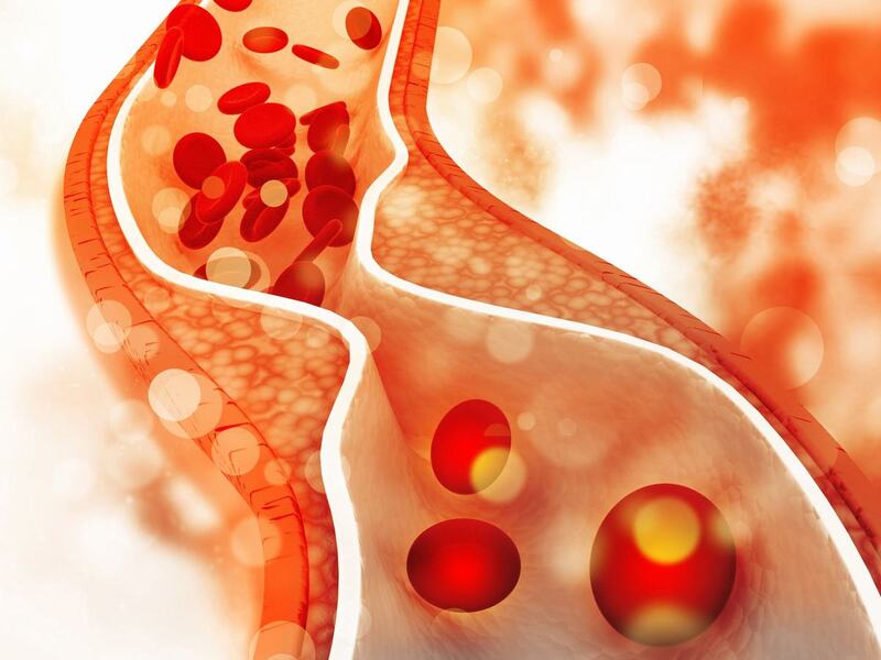 Bệnh co thắt mạch máu não có nguy hiểm không