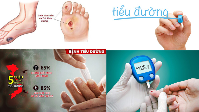Bệnh đái tháo đường là gì, triệu chứng và cách phòng bệnh