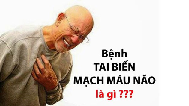 Bệnh tai biến mạch máu não là gì