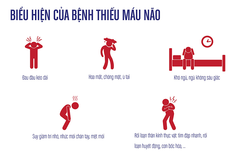 Bệnh thiểu năng tuần hoàn não là gì và cách phòng ngừa ra sao