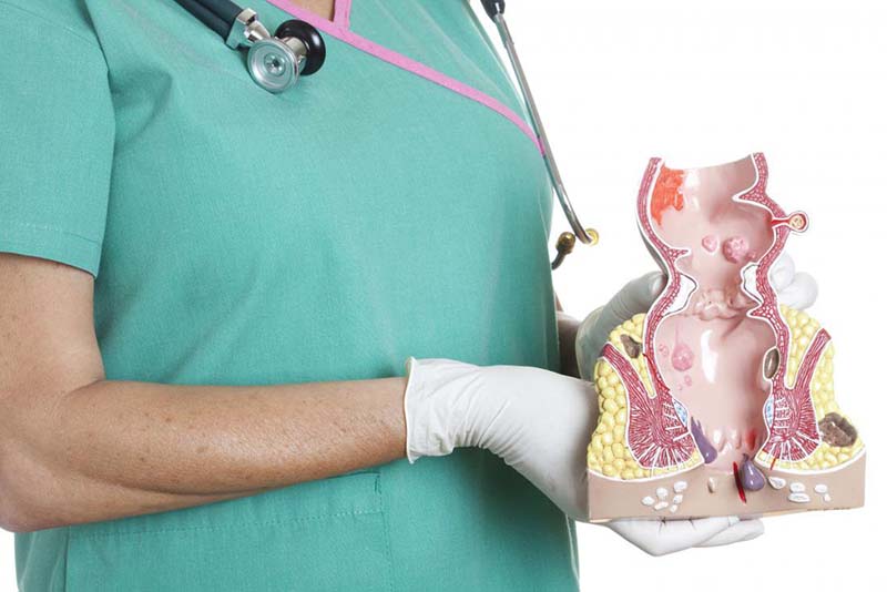 Trĩ nội có nguy hiểm không và cách điều trị ra sao