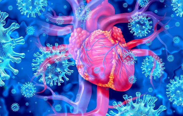 Bệnh viêm cơ tim có chữa khỏi được không và cách điều trị ra sao