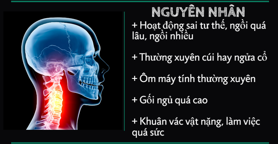 Bị thoái hóa đốt sống cổ nên làm gì tốt cho bệnh