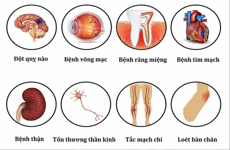 Biến chứng của bệnh tiểu đường với sức khỏe như thế nào