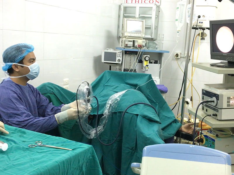 các phương pháp tán sỏi thận hiện nay như thế nào